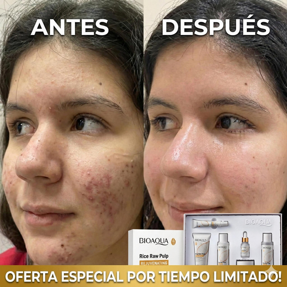 Kit de lujo X6 BIOAQUA+ ENVIO GRATIS